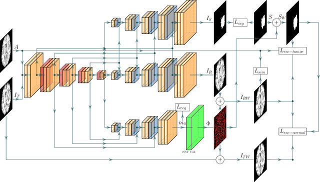 Figure 1 for A Deep Network for Joint Registration and Reconstruction of Images with Pathologies