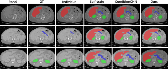 Figure 4 for Multi-organ Segmentation via Co-training Weight-averaged Models from Few-organ Datasets