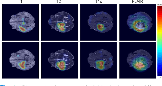 Figure 1 for Weakly supervised segmentation with cross-modality equivariant constraints