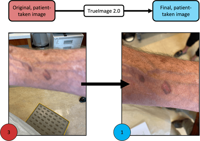 Figure 2 for Development and Clinical Evaluation of an AI Support Tool for Improving Telemedicine Photo Quality