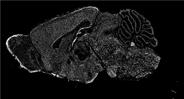 Figure 2 for Supervised and Unsupervised End-to-End Deep Learning for Gene Ontology Classification of Neural In Situ Hybridization Images