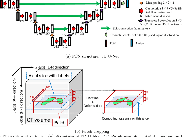 Figure 1 for Visualizing intestines for diagnostic assistance of ileus based on intestinal region segmentation from 3D CT images