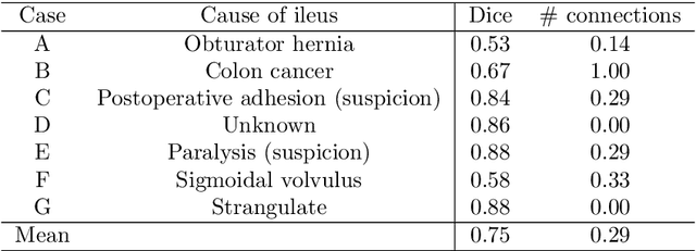 Figure 2 for Visualizing intestines for diagnostic assistance of ileus based on intestinal region segmentation from 3D CT images