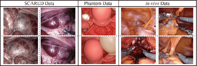 Figure 2 for Stereo Dense Scene Reconstruction and Accurate Laparoscope Localization for Learning-Based Navigation in Robot-Assisted Surgery