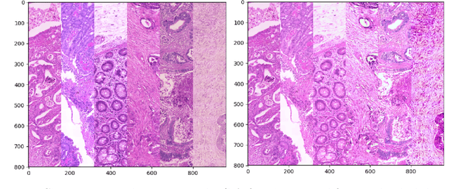 Figure 1 for Colorectal Cancer Outcome Prediction from H&E Whole Slide Images using Machine Learning and Automatically Inferred Phenotype Profiles