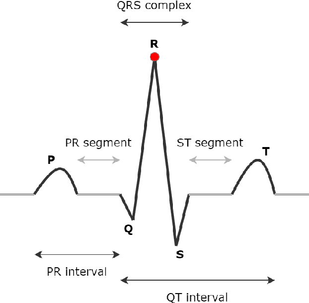 Figure 1 for Enhancing Deep Learning-based 3-lead ECG Classification with Heartbeat Counting and Demographic Data Integration