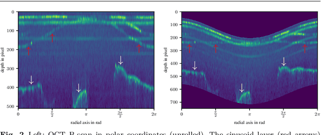 Figure 2 for Endoscopic vs. volumetric OCT imaging of mastoid bone structure for pose estimation in minimally invasive cochlear implant surgery