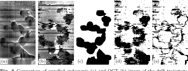 Figure 3 for Endoscopic vs. volumetric OCT imaging of mastoid bone structure for pose estimation in minimally invasive cochlear implant surgery