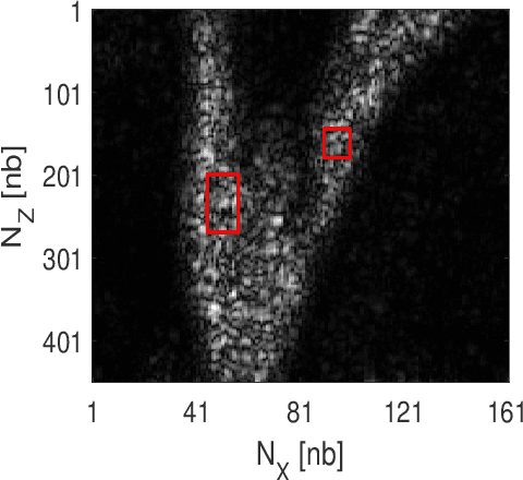 Figure 1 for Joint Blind Deconvolution and Robust Principal Component Analysis for Blood Flow Estimation in Medical Ultrasound Imaging