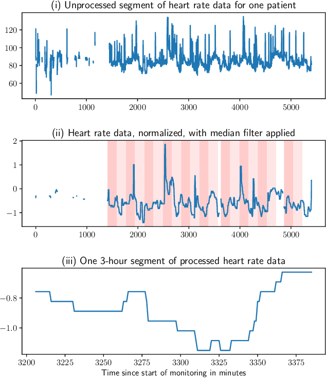 Figure 1 for Outlier detection of vital sign trajectories from COVID-19 patients
