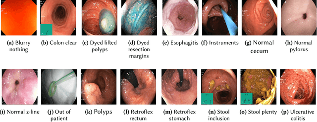 Figure 1 for An Extensive Study on Cross-Dataset Bias and Evaluation Metrics Interpretation for Machine Learning applied to Gastrointestinal Tract Abnormality Classification