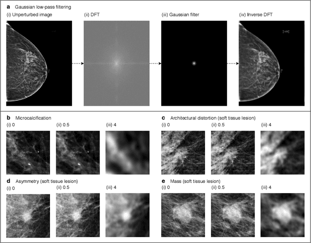 Figure 1 for Differences between human and machine perception in medical diagnosis