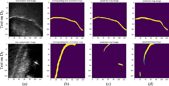 Figure 3 for Transfer Learning for Ultrasound Tongue Contour Extraction with Different Domains