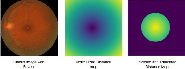 Figure 2 for Fundus Image Analysis for Age Related Macular Degeneration: ADAM-2020 Challenge Report