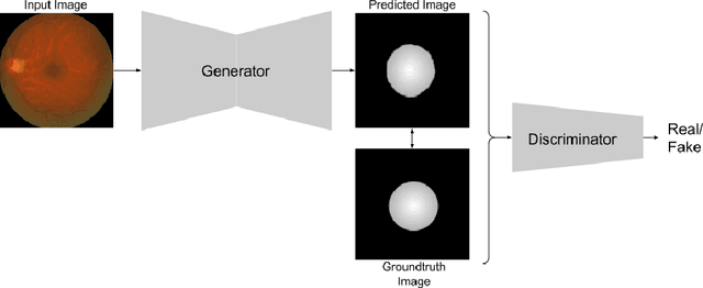 Figure 3 for Fundus Image Analysis for Age Related Macular Degeneration: ADAM-2020 Challenge Report
