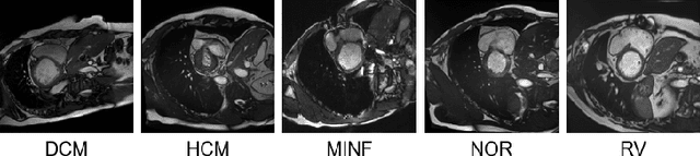 Figure 3 for Why patient data cannot be easily forgotten?