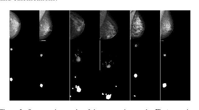 Figure 2 for Lightweight U-Net for High-Resolution Breast Imaging