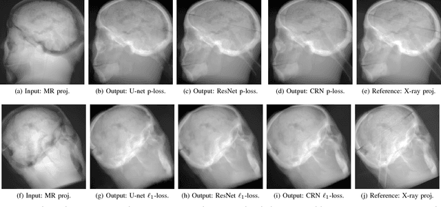 Figure 2 for MR to X-Ray Projection Image Synthesis