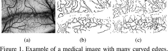 Figure 1 for Deep Faster Detection of Faint Edges in Noisy Images