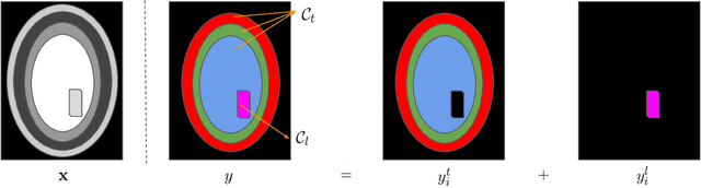 Figure 1 for Learning joint lesion and tissue segmentation from task-specific hetero-modal datasets