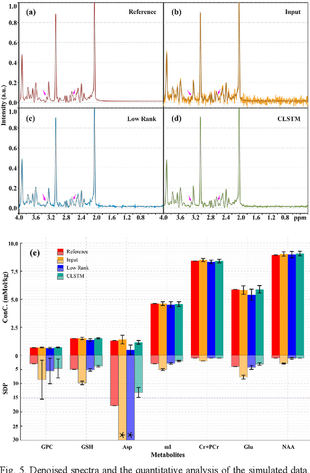 Figure 4 for Denoising Single Voxel Magnetic Resonance Spectroscopy with Deep Learning on Repeatedly Sampled In Vivo Data