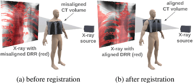 Figure 1 for Multiview 2D/3D Rigid Registration via a Point-Of-Interest Network for Tracking and Triangulation