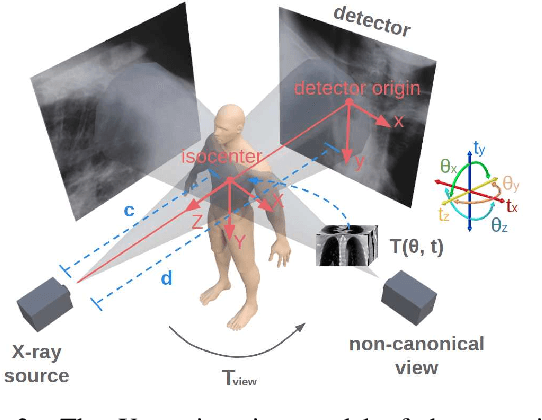 Figure 3 for Multiview 2D/3D Rigid Registration via a Point-Of-Interest Network for Tracking and Triangulation