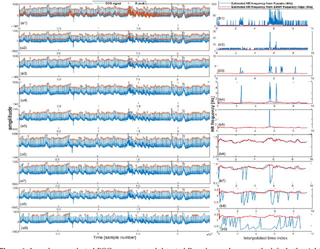 Figure 2 for Recognition of Patient Groups with Sleep Related Disorders using Bio-signal Processing and Deep Learning
