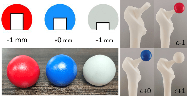 Figure 2 for A total hip surgery robot system based on intelligent positioning and optical measurement