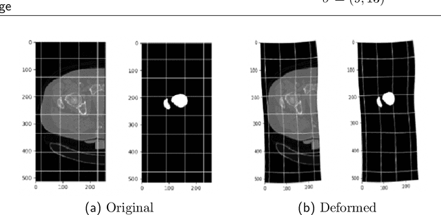 Figure 4 for Fast and Robust Femur Segmentation from Computed Tomography Images for Patient-Specific Hip Fracture Risk Screening