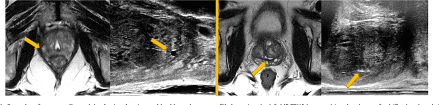 Figure 1 for Weakly-Supervised Convolutional Neural Networks for Multimodal Image Registration