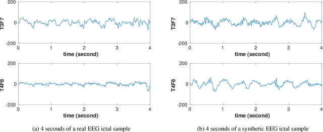 Figure 3 for Synthetic Epileptic Brain Activities Using Generative Adversarial Networks