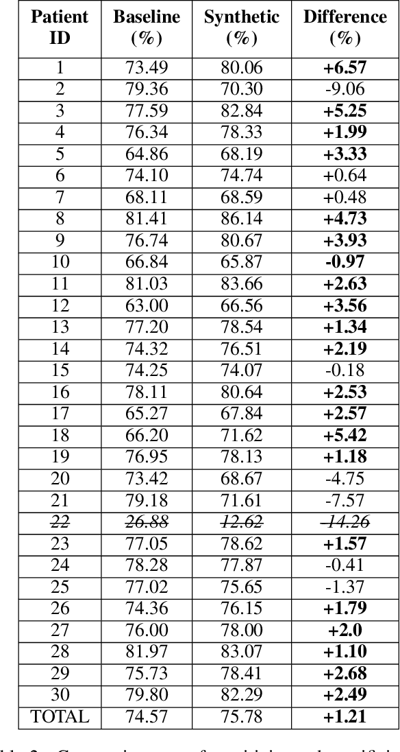 Figure 4 for Synthetic Epileptic Brain Activities Using Generative Adversarial Networks