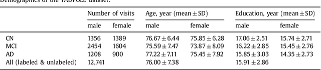 Figure 2 for Training recurrent neural networks robust to incomplete data: application to Alzheimer's disease progression modeling