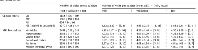 Figure 4 for Training recurrent neural networks robust to incomplete data: application to Alzheimer's disease progression modeling