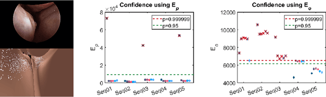 Figure 3 for Endoscopic navigation in the absence of CT imaging