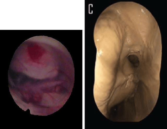 Figure 2 for Illumination-invariant image mosaic calculation based on logarithmic search