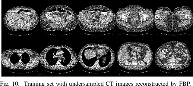 Figure 2 for Convolutional Sparse Coding for Compressed Sensing CT Reconstruction