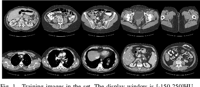 Figure 1 for Convolutional Sparse Coding for Compressed Sensing CT Reconstruction