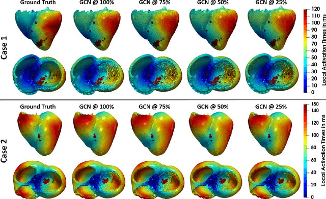 Figure 4 for Graph convolutional regression of cardiac depolarization from sparse endocardial maps