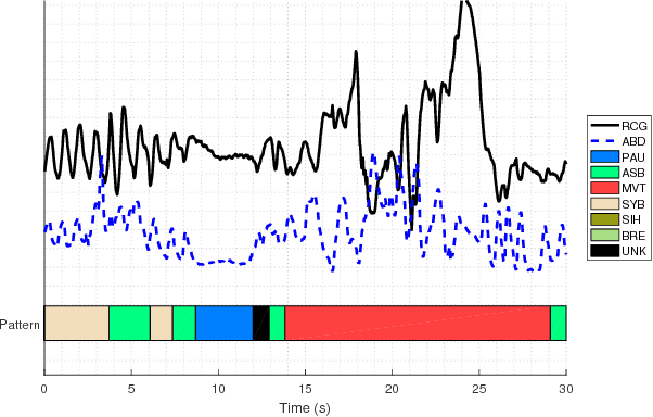 Figure 1 for A Semi-Markov Chain Approach to Modeling Respiratory Patterns Prior to Extubation in Preterm Infants