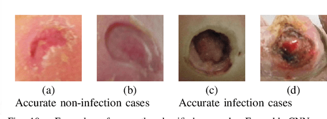 Figure 2 for Recognition of Ischaemia and Infection in Diabetic Foot Ulcers: Dataset and Techniques