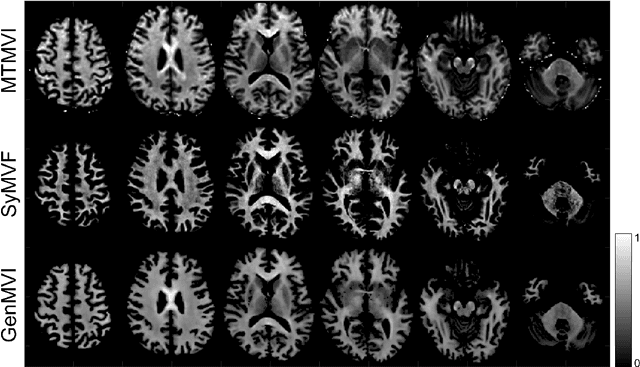 Figure 3 for The utility of a convolutional neural network for generating a myelin volume index map from rapid simultaneous relaxometry imaging