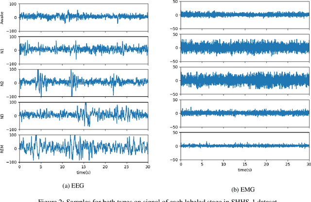 Figure 3 for Ensemble of Convolution Neural Networks on Heterogeneous Signals for Sleep Stage Scoring