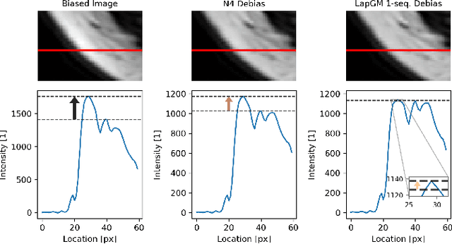 Figure 4 for LapGM: A Multisequence MR Bias Correction and Normalization Model