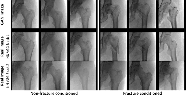 Figure 1 for Towards generative adversarial networks as a new paradigm for radiology education