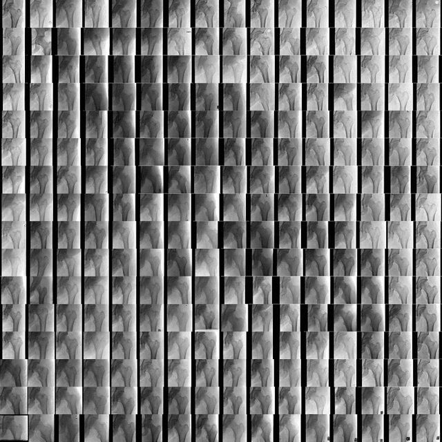 Figure 4 for Towards generative adversarial networks as a new paradigm for radiology education