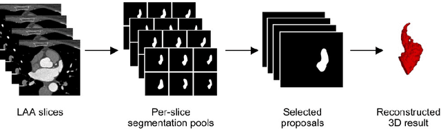 Figure 2 for A Survey of Left Atrial Appendage Segmentation and Analysis in 3D and 4D Medical Images