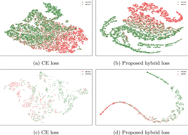 Figure 4 for ConCAD: Contrastive Learning-based Cross Attention for Sleep Apnea Detection