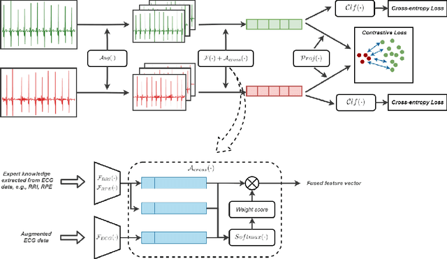 Figure 1 for ConCAD: Contrastive Learning-based Cross Attention for Sleep Apnea Detection
